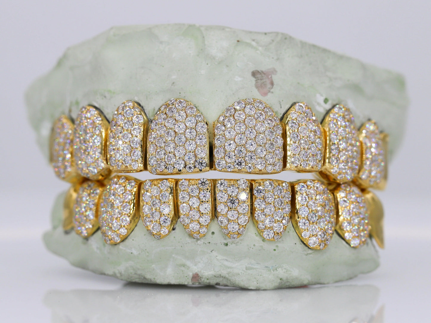 10 on 10 Capped VVS Moisannite Diamond Grillz