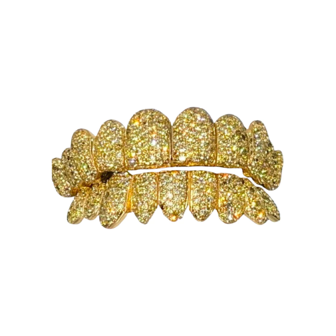 Custom Canary Hand Set Diamond Grillz (Zigzag Setting)