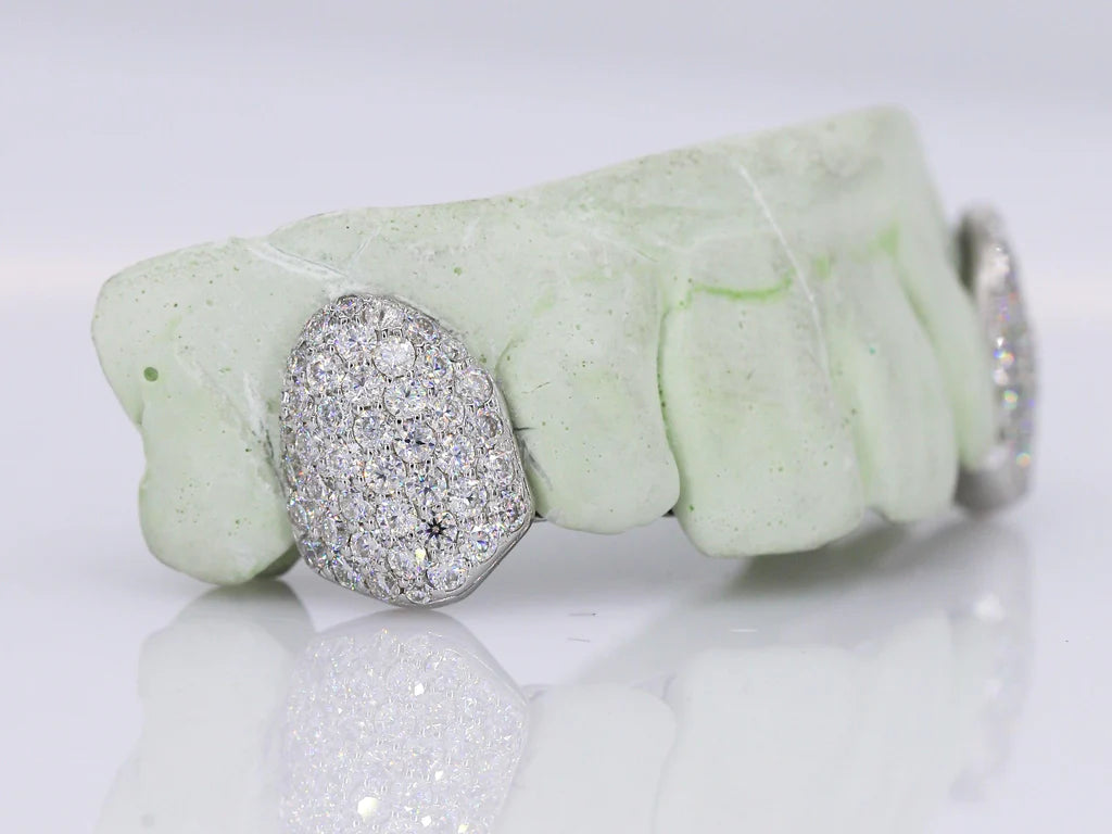 Diamond Fangs VVS Moisannite Diamond Grillz