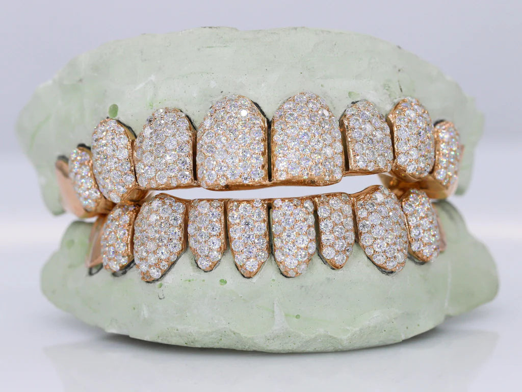 10 ON 10 Capped VVS Moisannite Diamond Grillz