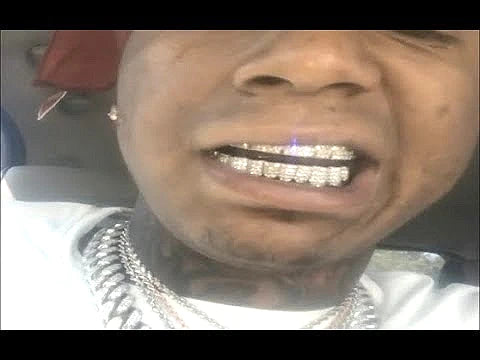 GMoney Bagg Yo's SI Diamond Grill