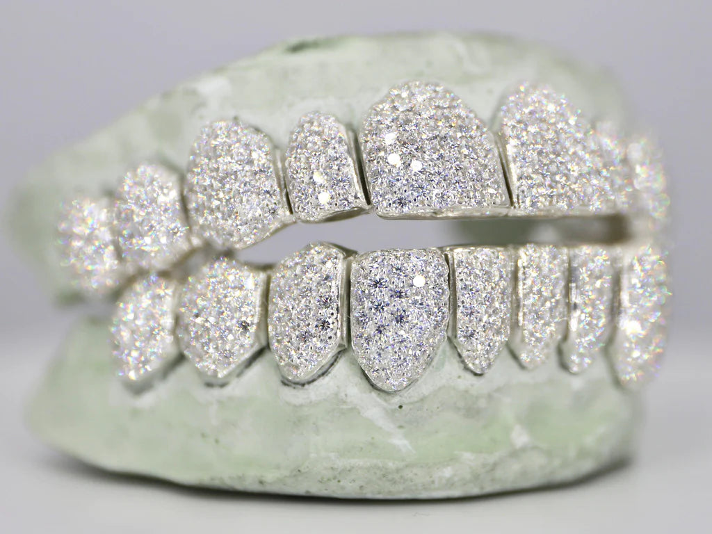 10 ON 10 VVS Moisannite Diamond Grillz