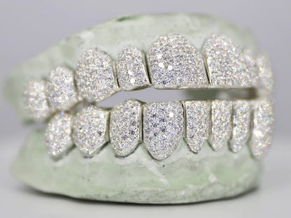 10 ON 10 VVS Moisannite Diamond Grillz