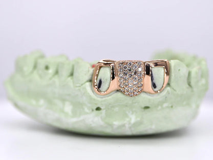 1 Tooth Diamond & 2 Teeth Open Faced VVS Moissanite Diamond Grillz