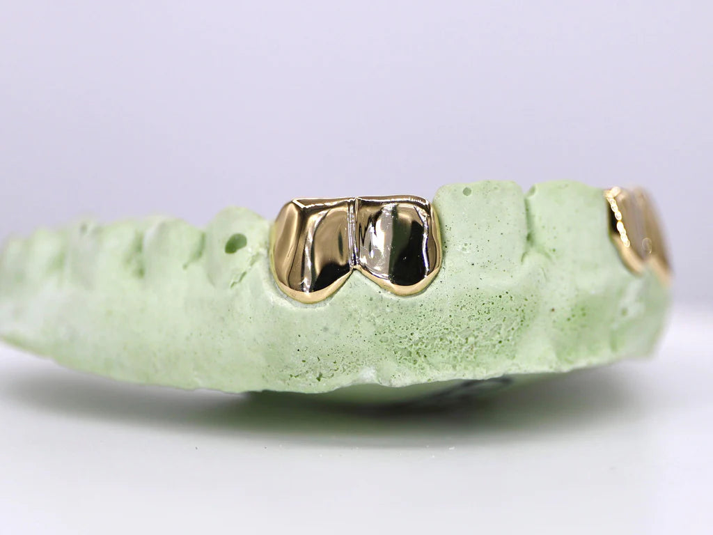 2 Solid Gold Teeth Grillz