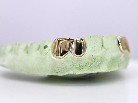 2 Solid Gold Teeth Grillz