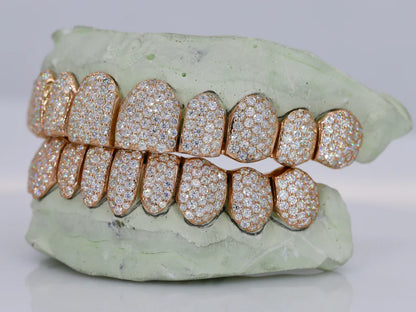 10 ON 10 VVS Moisannite Diamond Grillz