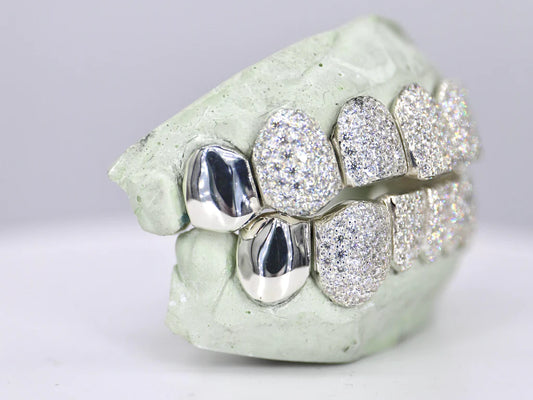 8 ON 8 Capped VVS Moisannite Diamond Grillz