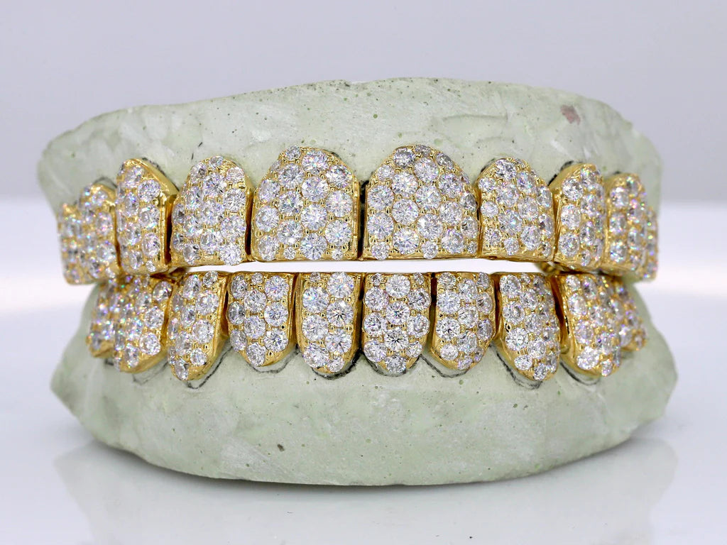 Jumbo VVS Moissanite Diamond Grillz