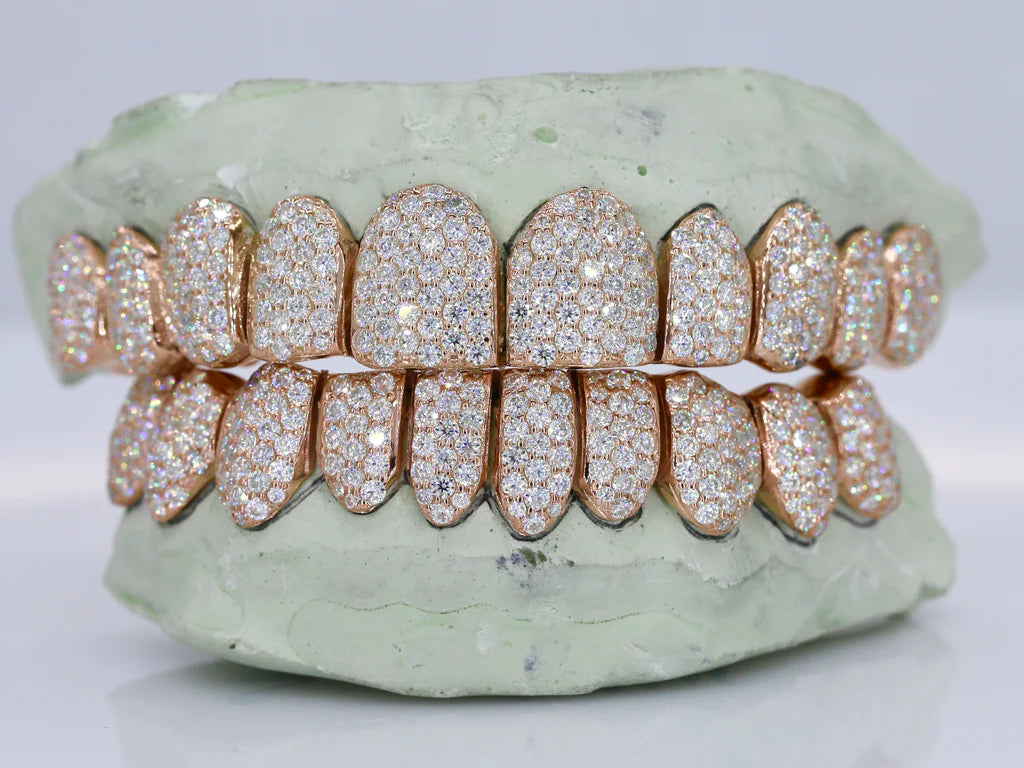 10 ON 10 VVS Moisannite Diamond Grillz