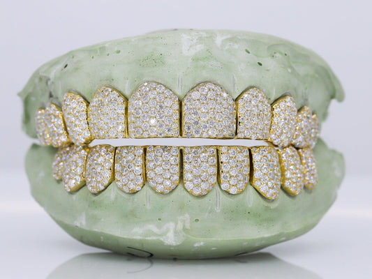 10 on 10 VVS Moisannite Diamond Grillz