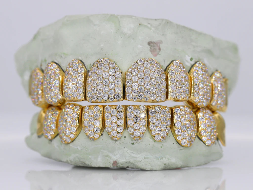 10 ON 10 Capped VVS Moisannite Diamond Grillz