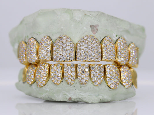 10 on 10 Capped VVS Moisannite Diamond Grillz