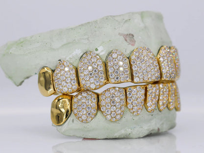 10 ON 10 Capped VVS Moisannite Diamond Grillz