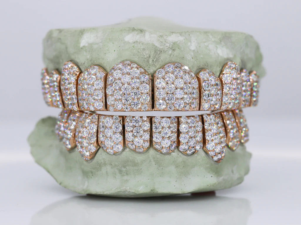 Jumbo VVS Moissanite Diamond Grillz