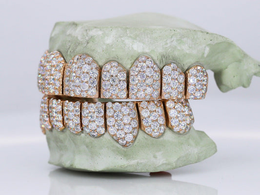 Jumbo VVS Moissanite Diamond Grillz