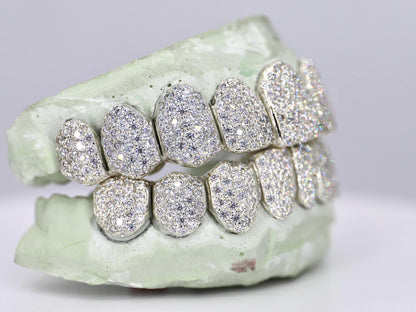 10 ON 10 VVS Moisannite Diamond Grillz