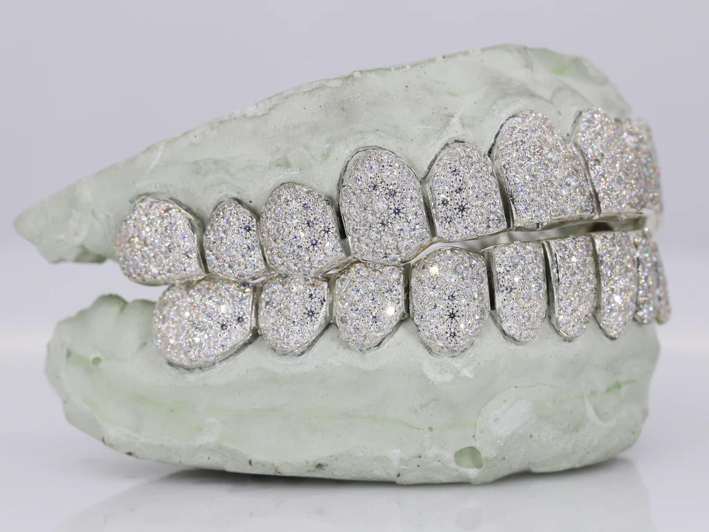 12 ON 12 VVS Moisannite Diamond Grillz