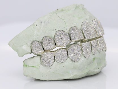VVS Lab Diamond Grillz