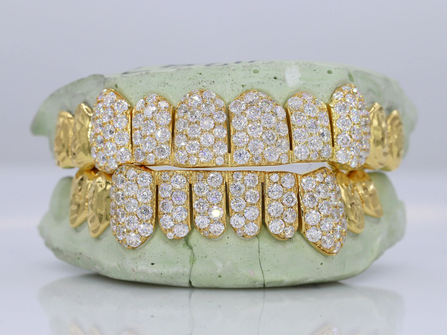 10 on 10 Jumbo Double Rose Cut Cap VVS Moissanite Diamond Grillz