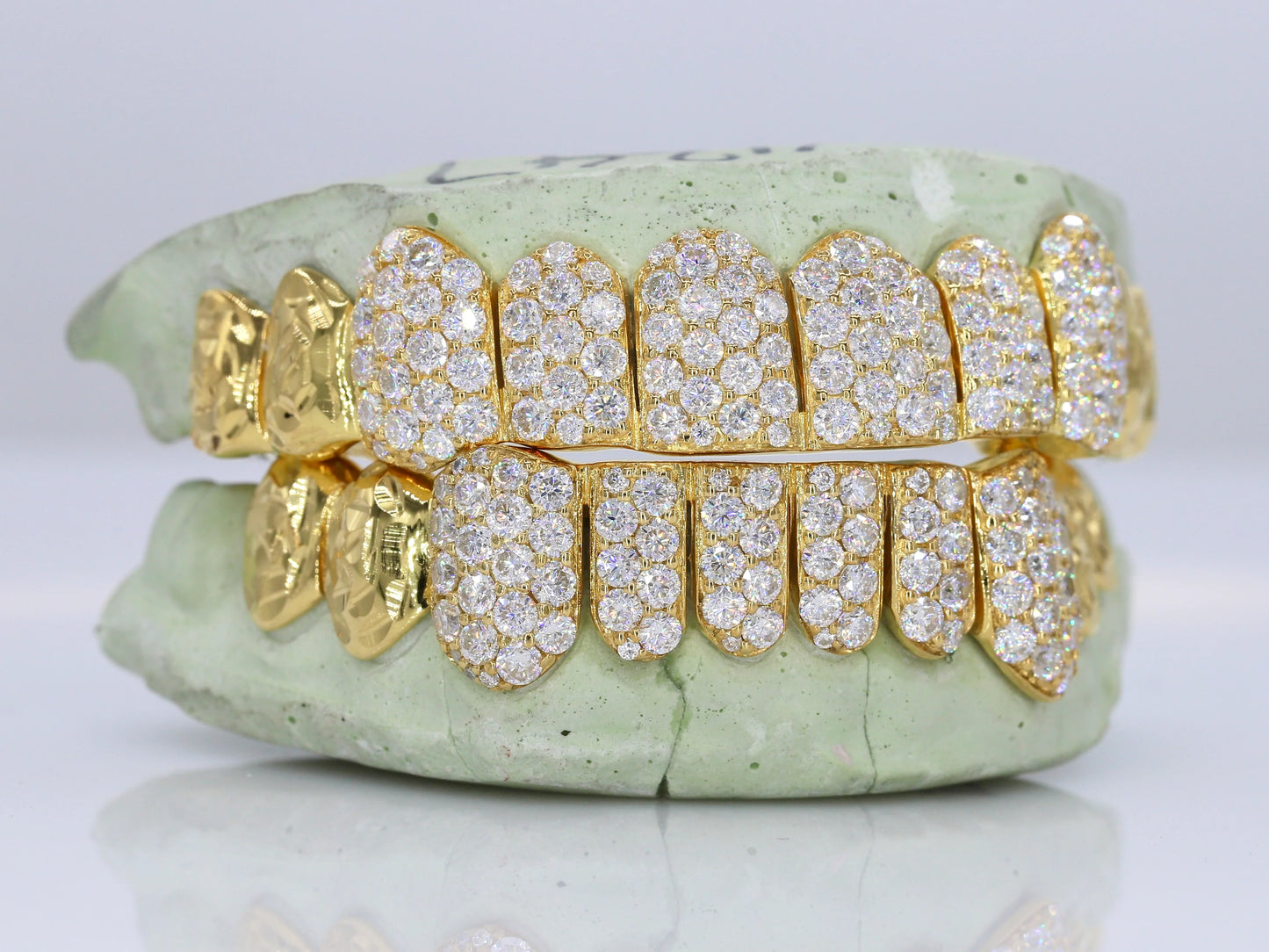 10 on 10 Jumbo Double Rose Cut Cap VVS Moissanite Diamond Grillz