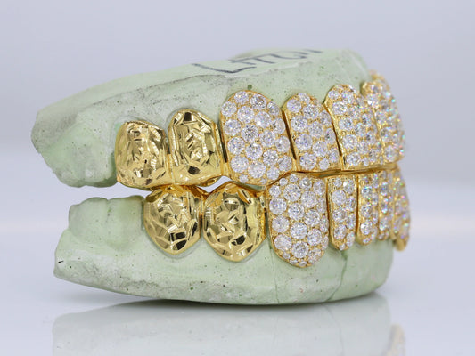 10 on 10 Jumbo Double Rose Cut Cap VVS Moissanite Diamond Grillz