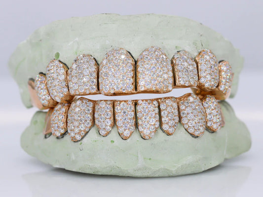 10 ON 10 Capped VVS Moisannite Diamond Grillz