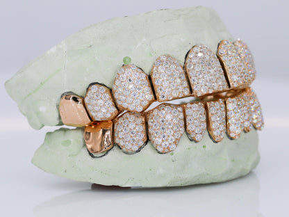 10 on 10 Capped VVS Moisannite Diamond Grillz