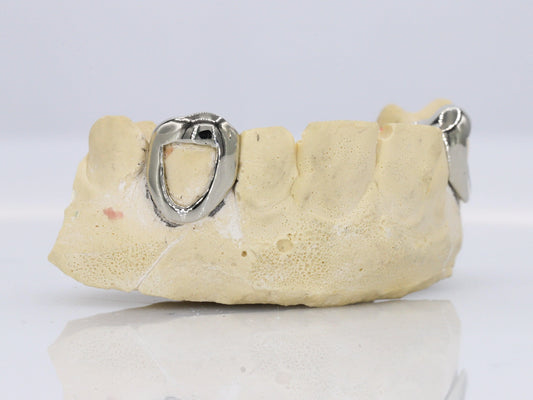 Framed Gold Fangs Grillz