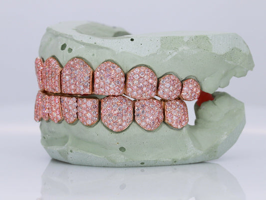 VVS Pink Lab Diamond Grillz