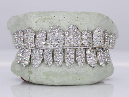 Jumbo VVS Moissanite Diamond Grillz