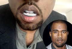 Kanye West's Choice Grillz