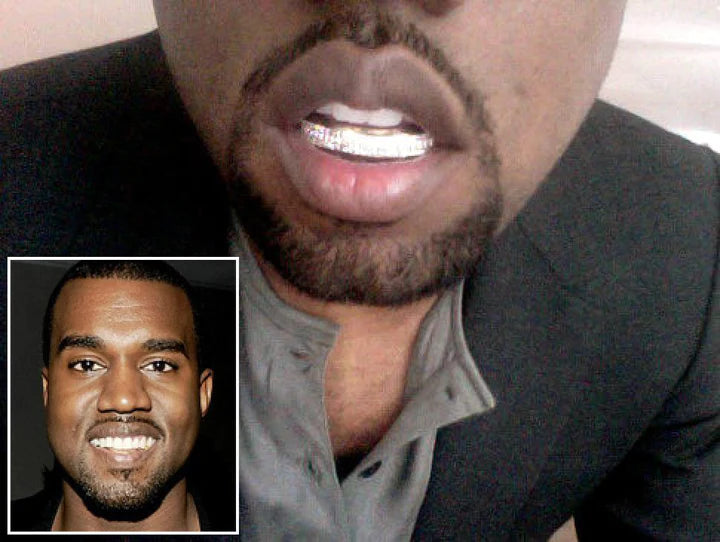 Kanye West's Choice Grillz