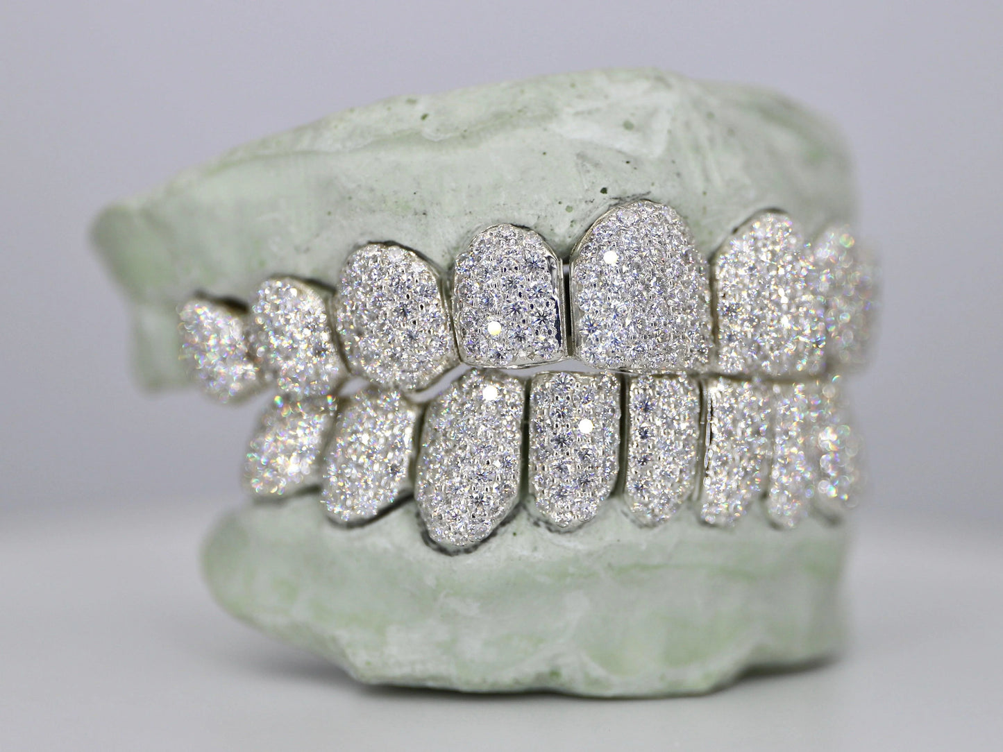 Customizable VVS Moissanite Diamond Grillz