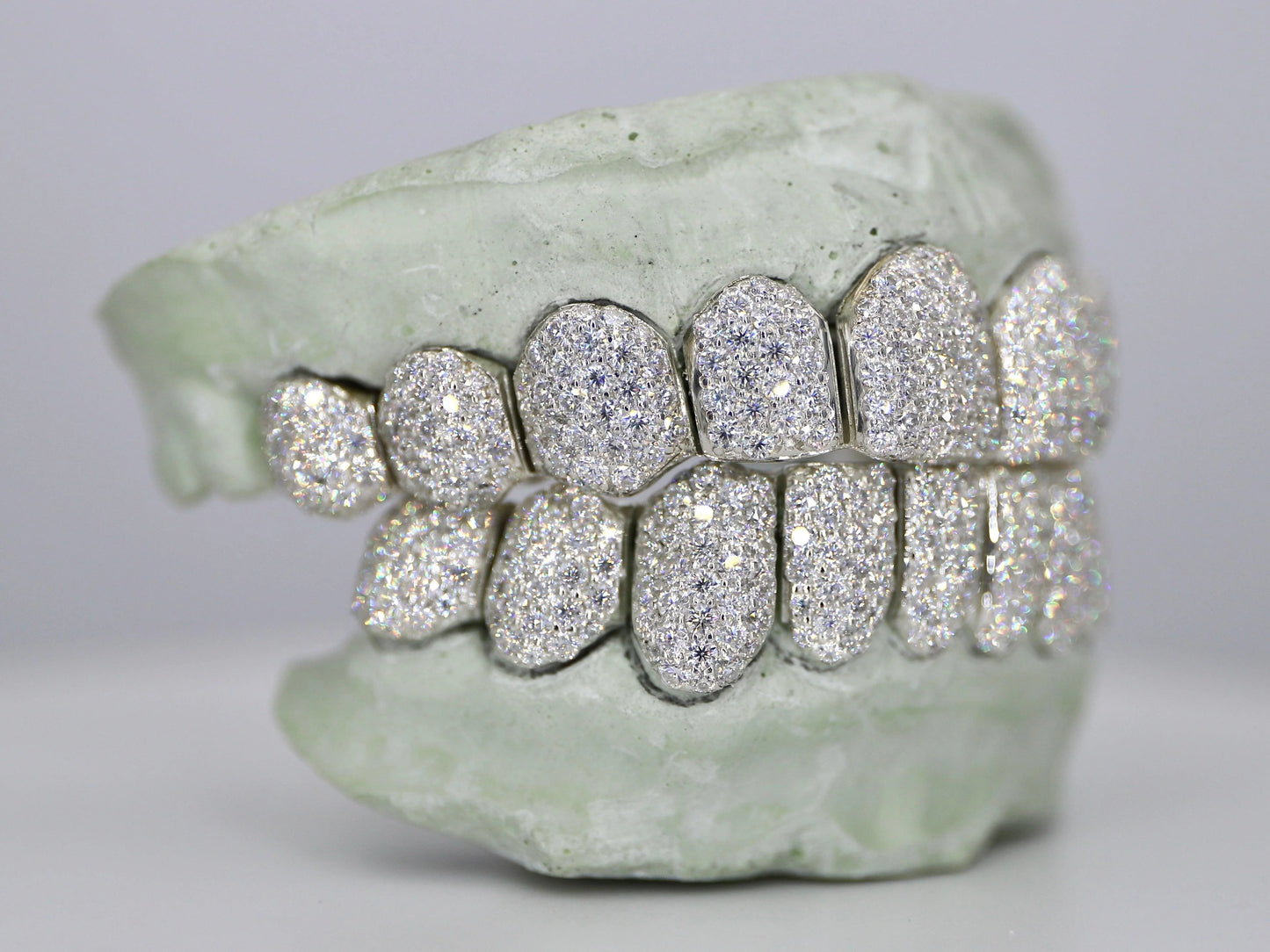 Customizable VVS Moissanite Diamond Grillz