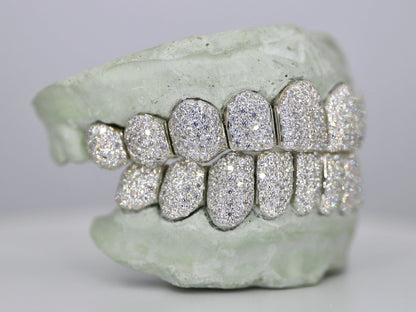 Customizable VVS Moissanite Diamond Grillz