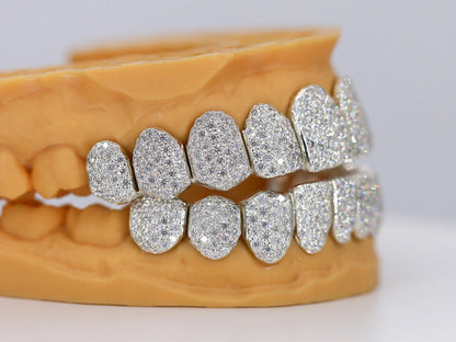 Custom Permanent VVS Moissanite Diamond Grillz