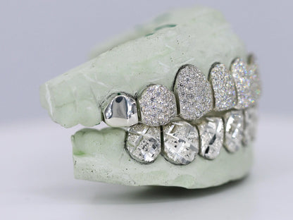 Diamond Top and Diamond Cut Bottom VVS Moisannite Diamond Grillz